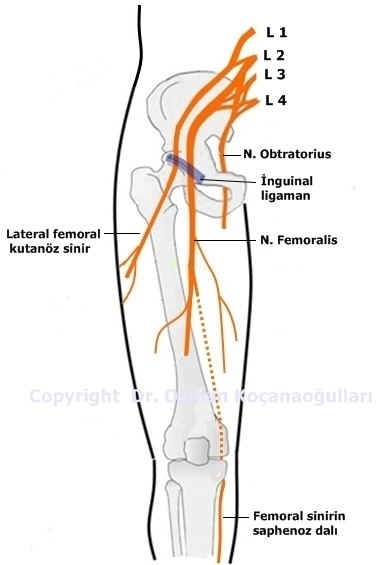 Femoral sinir tuzak nöropatisi